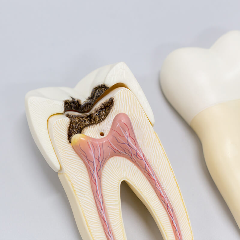 ROOT CANAL THERAPY Image for Scarsdale Endo